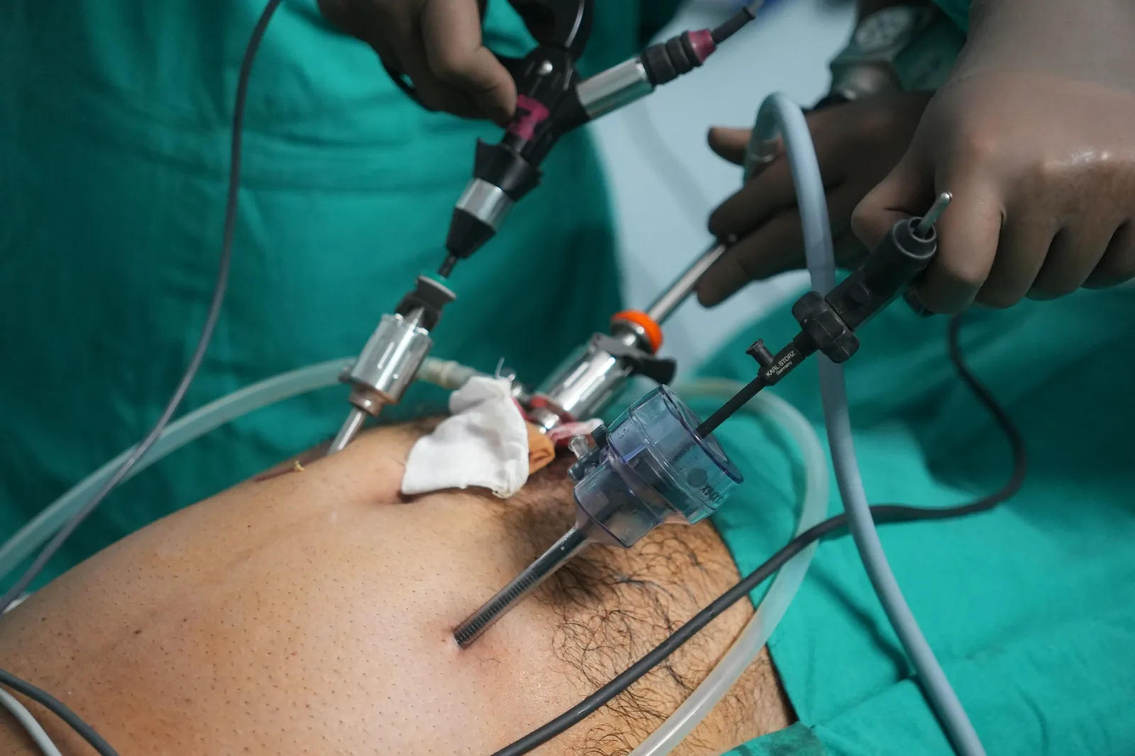 Laparoscopic instruments